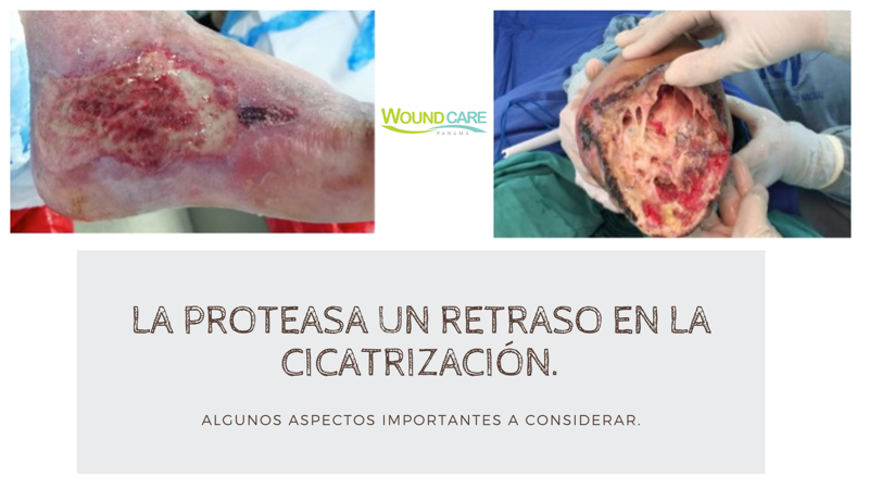 La Proteasa un Retraso en la Cicatrización.