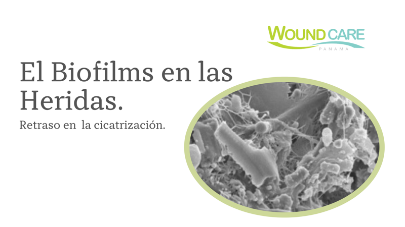 El Biofilms en las Heridas